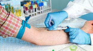 smoking and taking a blood test from a vein